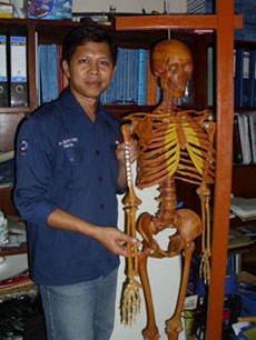 UGM Kembangakan Plat Penyambung Tulang Patah Ukuran Tulang Orang Indonesia