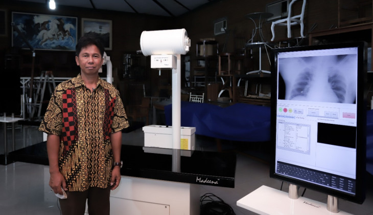 UGM Researcher Develops Covid-19 Detection Tool through Digital Radiography