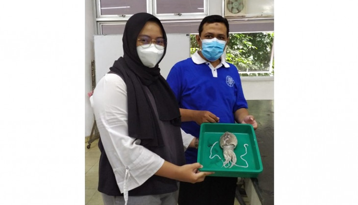  Mahasiswa UGM Teliti Cangkang Sotong Untuk Cegah Relaps Gigi Usai Lepas Behel