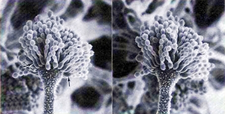 Aspergillus flavus, jamur penghasil aflatoksin (http://biologi.lipi.go.id)